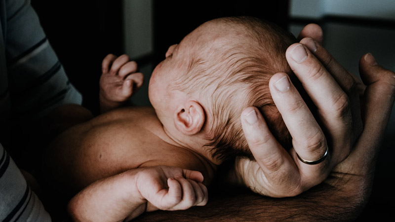 How to Manage Your Baby’s Cradle Cap