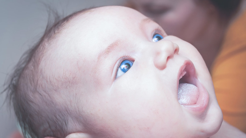 How To Manage Thrush In Newborns and Nursing Mothers