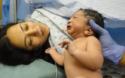 Common Caesarean Recovery Questions