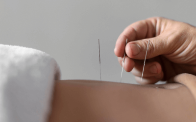 Acupuncture for Fertility: Every Couple Who Wants to Get Pregnant Should Read This!