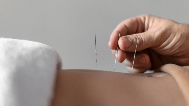 Acupuncture for Fertility: Every Couple Who Wants to Get Pregnant Should Read This!